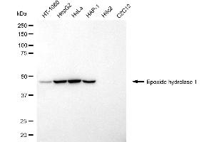Western blotting analysis using epoxide hydrolase 1 antibody (ABIN7798483).