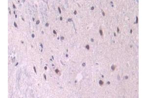 Detection of ENG in Rat Spinal cord Tissue using Polyclonal Antibody to Endoglin (ENG)