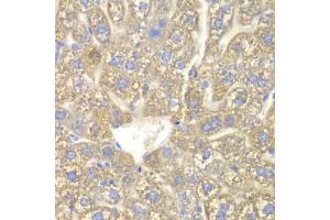 Immunohistochemistry of paraffin-embedded mouse liver using CYP2C18 antibody. (CYP2C18 anticorps)