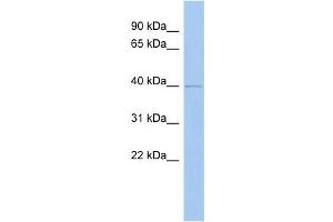 ZADH2 antibody used at 1 ug/ml to detect target protein. (ZADH2 anticorps  (N-Term))