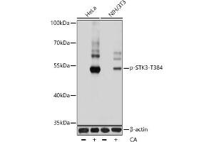 Western blot analysis of extracts of various cell lines, using Phospho-STK3/MST2-T384 antibody (ABIN7270222) at 1:1000 dilution.
