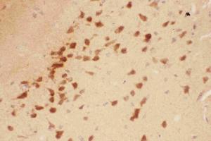 IHC analysis of BDNF using anti-BDNF antibody . (BDNF anticorps  (AA 129-247))