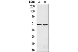Western blot analysis of CRHR2 expression in BC3H1 (A), U87MG (B) whole cell lysates.
