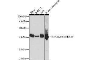 Western blot analysis of extracts of various cell lines, using MNX1/MNX1/HB9/HLXB9 Rabbit mAb (ABIN7268684) at 1:1000 dilution. (MNX1 anticorps)