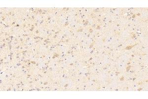 Detection of NOX3 in Rat Cerebrum Tissue using Polyclonal Antibody to Nicotinamide Adenine Dinucleotide Phosphate Oxidase 3 (NOX3) (NOX3 anticorps  (AA 221-466))