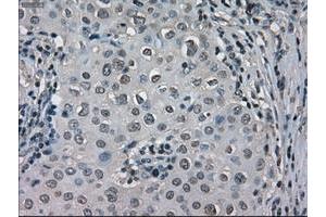 Image no. 4 for anti-Lactate Dehydrogenase A (LDHA) antibody (ABIN1499114)