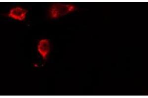 ABIN6275432 staining HeLa cells by IF/ICC. (RABEP2 anticorps  (Internal Region))