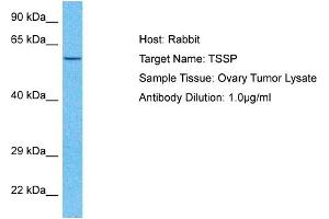 Host:  Rabbit  Target Name:  TSSP  Sample Type:  Ovary Tumor lysates  Antibody Dilution:  1.