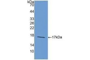 Detection of Recombinant LAMa1, Rat using Polyclonal Antibody to Laminin Alpha 1 (LAMA1) (Laminin alpha 1 anticorps  (AA 1156-1276))