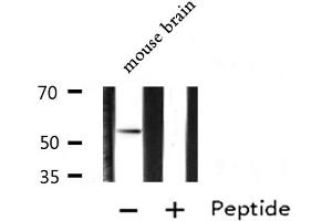 Western blot analysis of extracts from Mouse brain lysate, using ARX antibody.