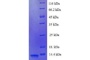 SDS-PAGE (SDS) image for LUC7-Like 3 (LUC7L3) (AA 1-79), (partial) protein (His tag) (ABIN5711225)