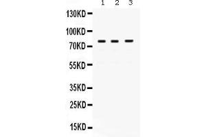 Anti- POLH Picoband antibody, Western blottingAll lanes: Anti POLH  at 0. (POLH anticorps  (AA 157-361))