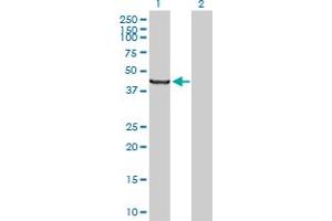 Western Blot analysis of SCLY expression in transfected 293T cell line by SCLY MaxPab polyclonal antibody. (SCLY anticorps  (AA 1-445))