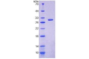 SDS-PAGE analysis of Human ALOX12B Protein. (ALOX12B Protéine)