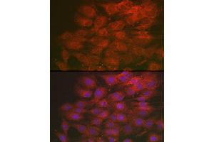 Immunofluorescence analysis of C6 cells using LML Rabbit pAb (ABIN7268204) at dilution of 1:250 (40x lens). (LMAN2L anticorps)