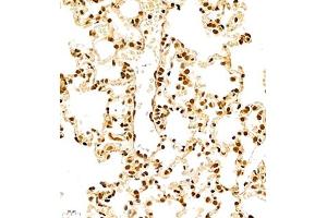 Immunohistochemistry of paraffin embedded rat lung using RB1 (ABIN7075477) at dilution of 1:700 (400x lens) (RBM45 anticorps)