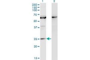 Western Blot analysis of KCNIP1 expression in transfected 293T cell line by KCNIP1 monoclonal antibody (M10), clone 3D9.
