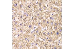 Immunohistochemistry of paraffin-embedded human liver injury using ST3GAL3 antibody (ABIN5974085) at dilution of 1/100 (40x lens). (ST3GAL3 anticorps)