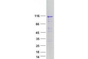 Validation with Western Blot