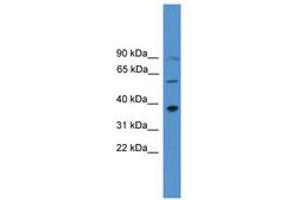 Image no. 1 for anti-Paired-Like Homeodomain 1 (PITX1) (AA 160-209) antibody (ABIN6745407)