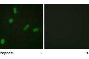 Immunofluorescence analysis of HeLa cells, using ETS1 polyclonal antibody . (ETS1 anticorps)