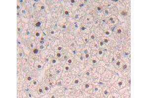 Used in DAB staining on fromalin fixed paraffin- embedded liver tissue