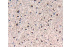 Used in DAB staining on fromalin fixed paraffin- embedded liver tissue (MECP2 anticorps  (AA 1-177))