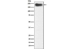 anti-Myosin, Heavy Chain 7B, Cardiac Muscle, beta (MYH7B) antibody