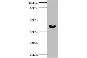 Western blot All lanes: Cytoplasmic protein NCK1 antibody at 4 μg/mL + Rat liver tissue Secondary Goat polyclonal to rabbit IgG at 1/10000 dilution Predicted band size: 43, 36 kDa Observed band size: 43 kDa (NCK1 anticorps  (AA 58-377))