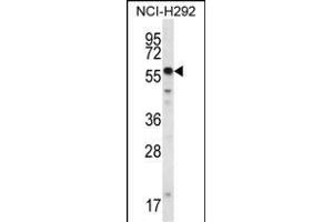 SMYD2 Antibody (N-term) (ABIN387897 and ABIN2844146) western blot analysis in NCI- cell line lysates (35 μg/lane).