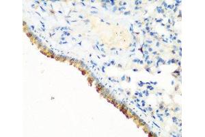 Immunohistochemistry of paraffin-embedded Mouse lung using CBL Polyclonal Antibody at dilution of 1:200 (40x lens). (CBL anticorps)
