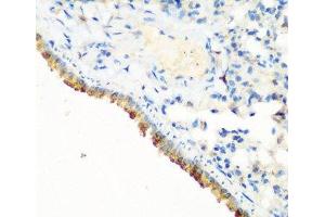 Immunohistochemistry of paraffin-embedded Mouse lung using CBL Polyclonal Antibody at dilution of 1:200 (40x lens).