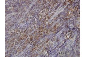 Image no. 1 for anti-RAS Guanyl Releasing Protein 4 (RASGRP4) (AA 574-674) antibody (ABIN599321) (RASGRP4 anticorps  (AA 574-674))