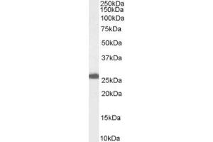 Western Blotting (WB) image for anti-Progesterone Receptor Membrane Component 1 (PGRMC1) (C-Term) antibody (ABIN2466103) (PGRMC1 anticorps  (C-Term))