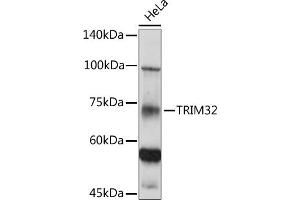 Western blot analysis of extracts of HeLa cells, using TRIM32 antibody (ABIN6132735, ABIN6149520, ABIN6149521 and ABIN6222878) at 1:500 dilution.
