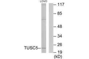Western blot analysis of extracts from LOVO cells, using TUSC5 antibody. (TUSC5 anticorps)