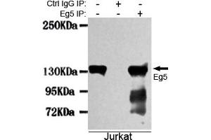 Immunoprecipitation analysis of Jurkat cell lysates using Eg5 mouse mAb.