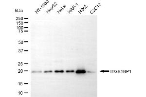 Western blotting analysis using ITGB1BP1 antibody (ABIN7799068). (ITGB1BP1 anticorps)