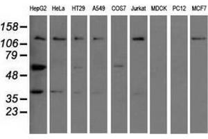 Western blot analysis of extracts (35 µg) from 9 different cell lines by using anti-IGF2BP2 monoclonal antibody. (IGF2BP2 anticorps)