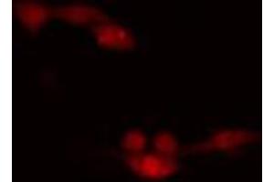 ABIN6266648 staining HeLa cells by IF/ICC. (CDK7 anticorps  (Internal Region))