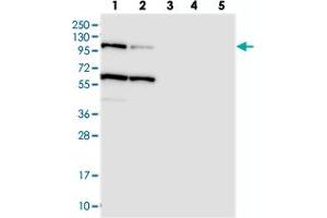 Western blot analysis of Lane 1: RT-4, Lane 2: U-251 MG, Lane 3: Human Plasma, Lane 4: Liver, Lane 5: Tonsil with USP6NL polyclonal antibody . (USP6NL anticorps)