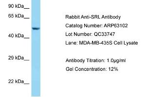 Western Blotting (WB) image for anti-Sarcalumenin (SRL) (C-Term) antibody (ABIN2789371) (Sarcalumenin anticorps  (C-Term))
