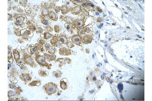 Rabbit Anti-ENO1 Antibody       Paraffin Embedded Tissue:  Human placenta cell   Cellular Data:  Epithelial cells of renal tubule  Antibody Concentration:   4. (ENO1 anticorps  (Middle Region))