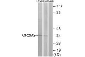 Western blot analysis of extracts from LOVO/A549 cells, using OR2M2 Antibody. (OR2M2 anticorps  (AA 281-330))