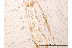 Immunoperoxidase of monoclonal antibody to SYT1 on formalin-fixed paraffin-embedded human smooth muscle.