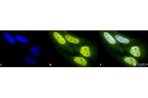 Immunocytochemistry/Immunofluorescence analysis using Rabbit Anti-Acetylated Lysine Polyclonal Antibody . (Lysine (lys) (acetylated) anticorps (PerCP))