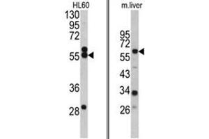 (LEFT) Western blot analysis of HMGCS1 antibody (Center) in HL60 cell line lysates (35ug/lane). (HMGCS1 anticorps  (Middle Region))