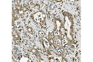 IHC analysis of ME2 using anti-ME2 antibody (ABIN7600967). (NAD-ME anticorps  (AA 26-584))