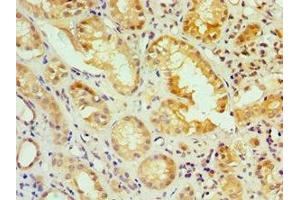 Immunohistochemistry of paraffin-embedded human kidney tissue using ABIN7156617 at dilution of 1:100 (IRF2 anticorps  (AA 120-349))