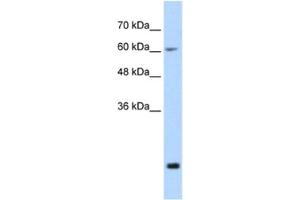 Western Blotting (WB) image for anti-Fused in Sarcoma (FUS) antibody (ABIN2462078) (FUS anticorps)